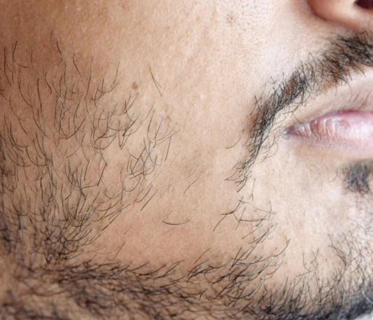 Fix a Patchy Beard